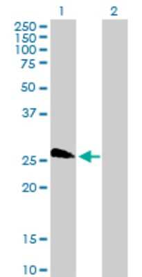 Western Blot: LOC391746 similar to TBP-associated factor 11 Antibody [H00391746-B01P] - Analysis of LOC391746 expression in transfected 293T cell line by LOC391746 polyclonal antibody.  Lane 1: LOC391746 transfected lysate(21.78 KDa). Lane 2: Non-transfected lysate.