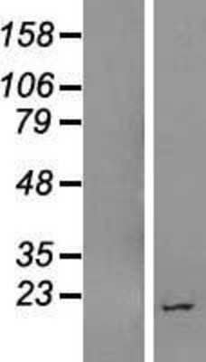 Western Blot: LOC400657 Overexpression Lysate (Adult Normal) [NBL1-12601] Left-Empty vector transfected control cell lysate (HEK293 cell lysate); Right -Over-expression Lysate for LOC400657.