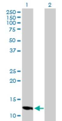 Western Blot: LOC494141 mitochondrial carrier triple repeat 1 pseudogene Antibody [H00494141-B01P] - Analysis of LOC494141 expression in transfected 293T cell line by LOC494141 polyclonal antibody.  Lane 1: LOC494141 transfected lysate(16.94 KDa). Lane 2: Non-transfected lysate.