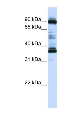 Western Blot: LOC645015 Antibody [NBP1-70613] - Human Placenta lysate, concentration 0.2-1 ug/ml.