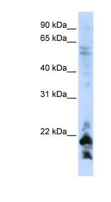 Western Blot: LOC647169 Antibody [NBP1-70614] - HepG2 cell lysate, concentration 0.2-1 ug/ml.