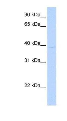 Western Blot: ALG1L3P Antibody [NBP1-70615] -  721_B cell lysate, concentration 0.2-1 ug/ml.