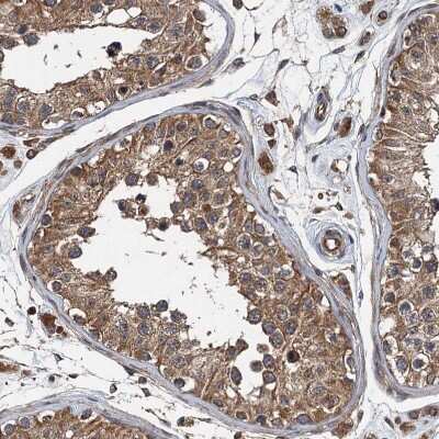 Immunohistochemistry-Paraffin: LOH12CR1 Antibody [NBP2-30597] - Staining of human testis shows moderate cytoplasmic positivity in cells in seminiferous ducts.