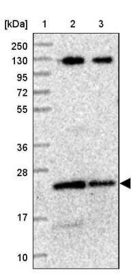 Western Blot: LOH12CR1 Antibody [NBP2-30597] - Lane 1: Marker  [kDa] 250, 130, 95, 72, 55, 36, 28, 17, 10.  Lane 2: Human cell line RT-4.  Lane 3: Human cell line U-251MG sp