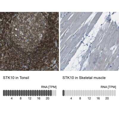 Immunohistochemistry-Paraffin: LOK Antibody [NBP2-13396] - Analysis in human tonsil and skeletal muscle tissues using NBP2-13396 antibody. Corresponding STK10 RNA-seq data are presented for the same tissues.