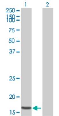 Western Blot: LOK Antibody [H00006793-B01P] - Analysis of STK10 expression in transfected 293T cell line by STK10 polyclonal antibody.  Lane 1: STK10 transfected lysate(15.95 KDa). Lane 2: Non-transfected lysate.
