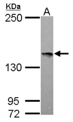 Western Blot: LOK Antibody [NBP2-19367] - Sample (30 ug of whole cell lysate) A: Raji 5% SDS PAGE gel, diluted at 1:500.