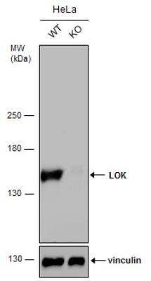 Western Blot: LOK Antibody [NBP2-19367] - Wild-type (WT) and LOK knockout (KO) HeLa cell extracts (30 ug) were separated by 5% SDS-PAGE, and the membrane was blotted with LOK antibody [C1C3]. HRP-conjugated anti-rabbit IgG antibody was used to detect the primary antibody.