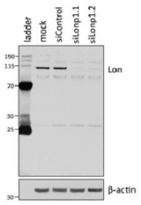 Western Blot: LONP1 Antibody (LON20/H1) [NBP2-50478] - U87 cells were transfected with siRNA against the Lon protease (siLonp1.1 and siLonp1.2) or a control sequence (siControl) or transfection reagent alone (mock) and then western blotted using anti-LONP1 [LON20/H1] and a loading control antibody (B-actin). Molecular weight markers are labelled in kilodaltons