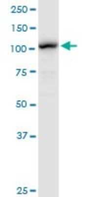 Western Blot: LONP1 Antibody [H00009361-D01P] - Analysis of LONP1 expression in HepG2.