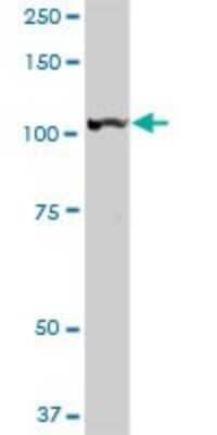 Western Blot: LONP1 Antibody [H00009361-D01P] - Analysis of LONP1 expression in human kidney.