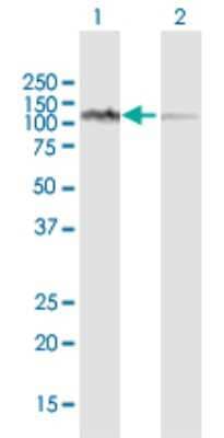 Western Blot: LONP1 Antibody [H00009361-D01P] - Analysis of LONP1 expression in transfected 293T cell line by LONP1 polyclonal antibody.Lane 1: LONP1 transfected lysate(106.50 KDa).Lane 2: Non-transfected lysate.