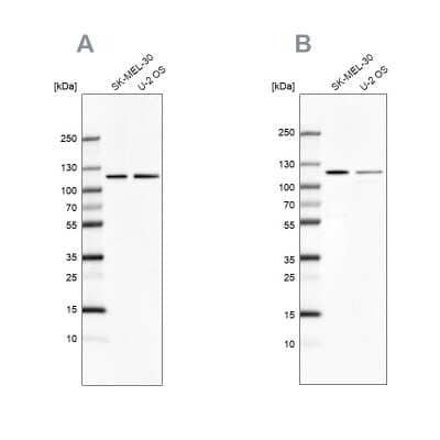 Western Blot: LONP1 Antibody [NBP2-76504] - Western blot analysis using Anti-LONP1 antibody NBP2-76504 (A) shows similar pattern to independent antibody NPB1-81734 (B).