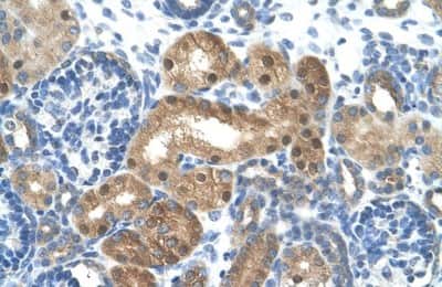 Immunohistochemistry-Paraffin: LONRF1 Antibody [NBP1-55072] - Human kidney Tissue, antibody concentration 4-8ug/ml. Cells with positive label: renal corpuscle cells (indicated with arrows) 400X magnification.