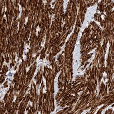 Immunohistochemistry-Paraffin: LONRF1 Antibody [NBP1-83579] - Staining of human smooth muscle shows strong cytoplasmic positivity.
