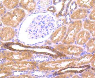 Immunohistochemistry-Paraffin: LOX-1/OLR1 Antibody [NBP2-89136] - Analysis of human kidney tissue using anti-LOX1 antibody. Counter stained with hematoxylin.