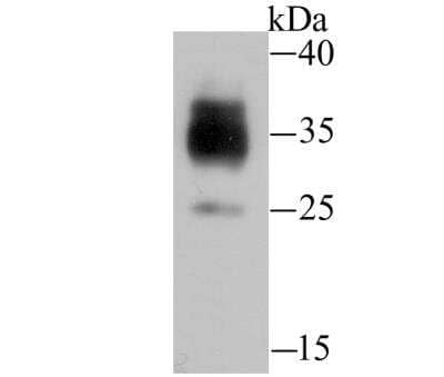 Western Blot: LOX-1/OLR1 Antibody [NBP2-89136] - Analysis of LOX1 on siHa cell lysate using anti-LOX1 antibody at 1/100 dilution.