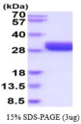 SDS-Page: Recombinant Human LOX-1/OLR1 Protein [NBP2-53074] - 15% SDS-PAGE (3ug)