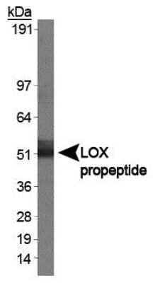 Western Blot: LOX Antibody [NB100-2528] - Analysis of LOX in human kidney