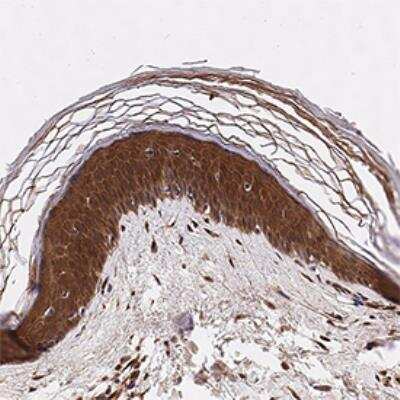 Immunohistochemistry-Paraffin: LOX propeptide Antibody [NBP1-30012] - IHC analysis of formalin fixed paraffin-embedded (FFPE) human skin using LOX propeptide antibody at 1:50 on a Bond Rx autostainer (Leica Biosystems). The assay involved 20 minutes of heat induced antigen retrieval (HIER) using 10mM sodium citrate buffer (pH 6.0) and endogenous peroxidase quenching with peroxide block. The sections were incubated with primary antibody for 30 minutes and Bond Polymer Refine Detection (Leica Biosystems) with DAB was used for signal development followed by counterstaining with hematoxylin. Whole slide scanning and capturing of representative images was performed using Aperio AT2 (Leica Biosystems). Cytoplasmic and plasma membrane staining was observed. Staining was performed by Histowiz.