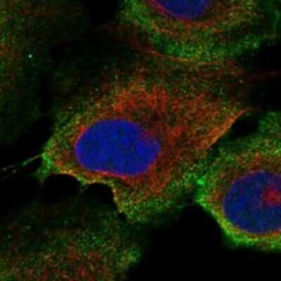 Immunocytochemistry/ Immunofluorescence LOXHD1 Antibody