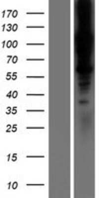 Western Blot: LOXL1 Overexpression Lysate (Adult Normal) [NBP2-07730] Left-Empty vector transfected control cell lysate (HEK293 cell lysate); Right -Over-expression Lysate for LOXL1.