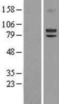 Western Blot Lysyl Oxidase Homolog 2/LOXL2 Overexpression Lysate