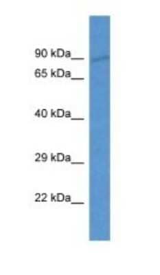 Western Blot: LOXL4 Antibody [NBP1-74257] - Titration: 1.0 ug/ml Positive Control: Fetal Heart.