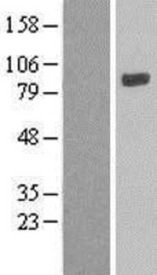 Western Blot: LOXL4 Overexpression Lysate (Adult Normal) [NBL1-12642] Left-Empty vector transfected control cell lysate (HEK293 cell lysate); Right -Over-expression Lysate for LOXL4.