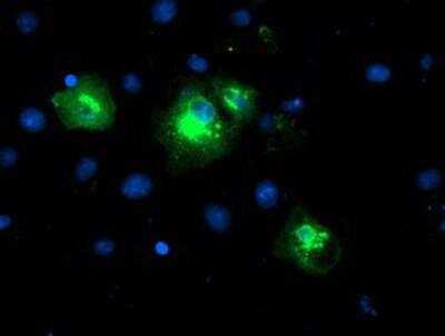 Immunocytochemistry/Immunofluorescence: LPAR1/LPA1/EDG-2 Antibody (1G6) [NBP2-01354] - Staining of COS7 cells transiently transfected by pCMV6-ENTRY EDG2.