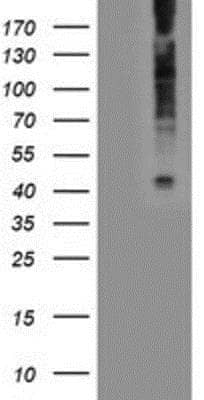 Western Blot: LPAR1/LPA1/EDG-2 Antibody (1G6) [NBP2-01354] -  HEK293T cells were transfected with the pCMV6-ENTRY control (Left lane) or pCMV6-ENTRY EDG2 (Right lane) cDNA for 48 hrs and lysed. Equivalent amounts of cell lysates (5 ug per lane) were separated by SDS-PAGE and immunoblotted with anti-EDG2.