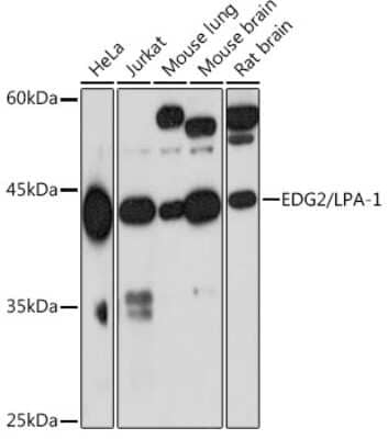 Western Blot: LPAR1/LPA1/EDG-2 Antibody (3U1Q0) [NBP3-15851] - Analysis of extracts of various cell lines, using LPAR1/LPA1/EDG-2 Rabbit mAb (NBP3-15851) at 1:1000 dilution. Secondary antibody: HRP Goat Anti-Rabbit IgG (H+L) at 1:10000 dilution. Lysates/proteins: 25ug per lane. Blocking buffer: 3% nonfat dry milk in TBST. Detection: ECL Basic Kit. Exposure time: 90s.