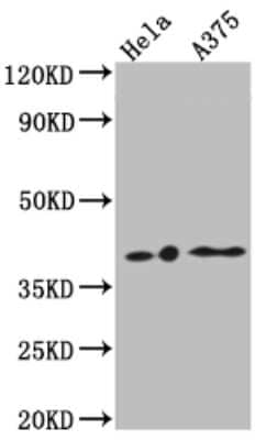 Western Blot: LPAR1/LPA1/EDG-2 Antibody (4C3) [NBP3-15186] - Positive WB detected in: Hela whole cell lysate, A375 whole cell lysate. All lanes: LPAR1/LPA1/EDG-2 antibody at 1:1000. Secondary: Goat polyclonal to rabbit IgG at 1/50000 dilution. Predicted band size: 42, 42 KDa. Observed band size: 42 KDa.