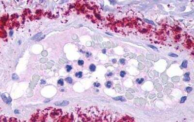 Immunohistochemistry-Paraffin: LPAR1/LPA1/EDG-2 Antibody [NLS211] - Lung, Asthma, Vessel