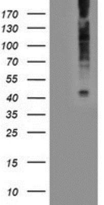 Western Blot: LPAR1/LPA1/EDG-2 Antibody (OTI1G6) - Azide and BSA Free [NBP2-72519] - HEK293T cells were transfected with the pCMV6-ENTRY control (Left lane) or pCMV6-ENTRY EDG2 (Right lane) cDNA for 48 hrs and lysed. Equivalent amounts of cell lysates (5 ug per lane) were separated by SDS-PAGE and immunoblotted with anti-EDG2.