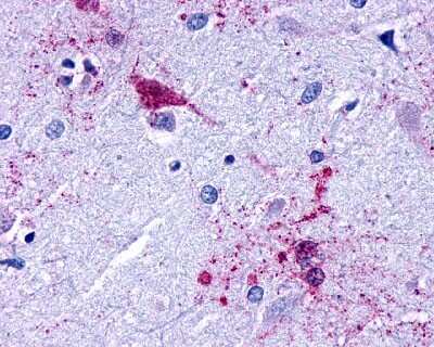 Immunohistochemistry-Paraffin: LPAR2/LPA2/EDG-4 Antibody [NLS1014] - Analysis of anti-EDG7 antibody with human brain, amygdala.