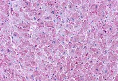Immunohistochemistry-Paraffin: LPAR2/LPA2/EDG-4 Antibody [NLS1014] - Human heart, diabetes formalin-fixed, paraffin-embedded tissue after heat-induced antigen retrieval.