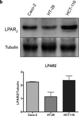 Western Blot: LPAR2/LPA2/EDG-4 Antibody [NBP1-84904] - Representative western blot and densitometric analysis of Caco-2, HT-29 and HCT-116 cells using specific antibodies against LPAR2/LPA2/EDG-4. Caco-2 cells express high levels of LPAR2/LPA2/EDG-4. The average scores +/- SEM is shown. Image collected and cropped by CiteAb from the following publication (//pubmed.ncbi.nlm.nih.gov/26418031/) licensed under a CC-BY license.