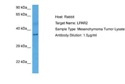 Western Blot: LPAR2/LPA2/EDG-4 Antibody [NBP2-87735] - Host: Rabbit. Target Name: LPAR2. Sample Tissue: Human Mesenchymoma Tumor lysates. Antibody Dilution: 1ug/ml