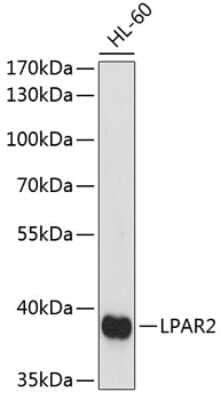 Western Blot: LPAR2/LPA2/EDG-4 Antibody [NBP3-02981] - Analysis of extracts of HL-60 cells, using LPAR2/LPA2/EDG-4 antibody at 1:1000 dilution. Secondary antibody: HRP Goat Anti-Rabbit IgG (H+L) at 1:10000 dilution. Lysates/proteins: 25ug per lane. Blocking buffer: 3% nonfat dry milk in TBST. Detection:Basic ECL Kit