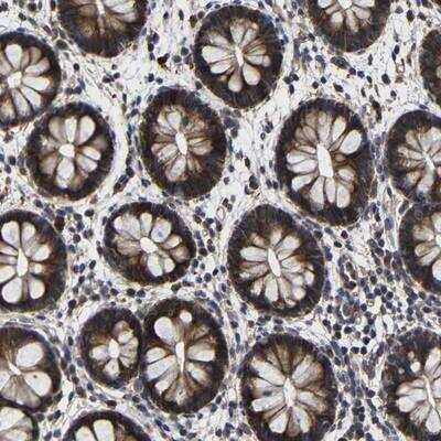 Immunohistochemistry: LPAR5/LPA5/GPR92 Antibody [NBP1-91961] - Staining of human rectum shows strong cytoplasmic positivity in glandular cells.