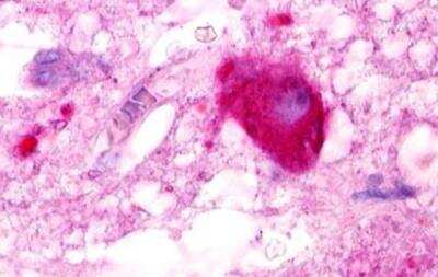 Immunohistochemistry-Paraffin: LPAR5/LPA5/GPR92 Antibody [NLS428] - Brain, hypothalamus