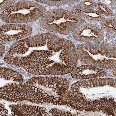 Immunohistochemistry-Paraffin: LPAR6/P2RY5 Antibody [NBP2-14197] - P2RY5 Antibody [NBP2-14197] - Staining of human stomach shows strong cytoplasmic and membranous positivity in glandular cells.