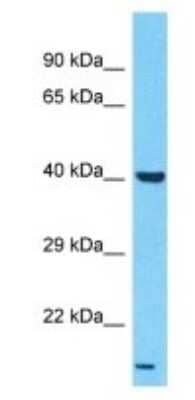 Western Blot: LPAR6/P2RY5 Antibody [NBP3-09507] - Western blot analysis of LPAR6/P2RY5 in Hela Whole Cell lysates. Antibody dilution at 1.0ug/ml