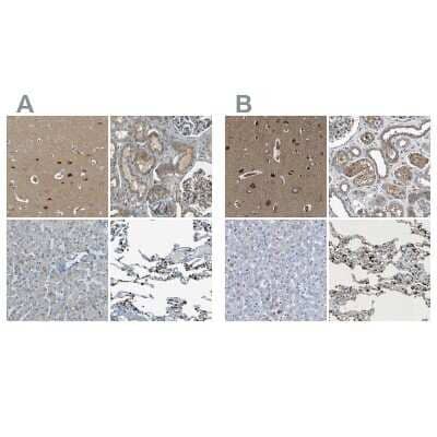 <b>Independent Antibodies Validation. </b>Immunohistochemistry-Paraffin: LPCAT1 Antibody [NBP1-88922] - Staining of human cerebral cortex, kidney, liver and lung using Anti-LPCAT1 antibody NBP1-88922 (A) shows similar protein distribution across tissues to independent antibody NBP1-88923 (B).