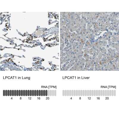 <b>Orthogonal Strategies Validation. </b>Immunohistochemistry-Paraffin: LPCAT1 Antibody [NBP1-88922] - Analysis in human lung and liver tissues. Corresponding LPCAT1 RNA-seq data are presented for the same tissues.