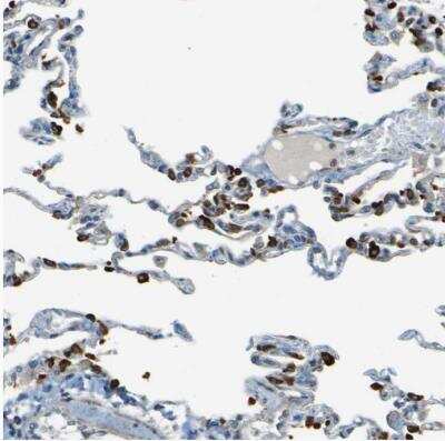 Immunohistochemistry-Paraffin: LPCAT1 Antibody [NBP1-88922] - Staining of human lung shows moderate to strong cytoplasmic positivity in pneumocytes.