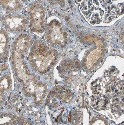 Immunohistochemistry-Paraffin: LPCAT1 Antibody [NBP1-88922] - Staining of human kidney shows weak to moderate cytoplasmic positivity in cells in tubules.