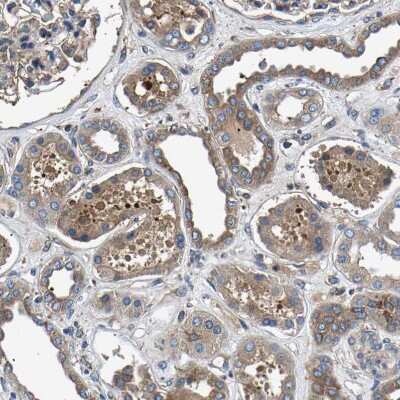 Immunohistochemistry-Paraffin: LPCAT1 Antibody [NBP1-88923] - Staining of human kidney shows weak to moderate cytoplasmic positivity in cells in tubules.