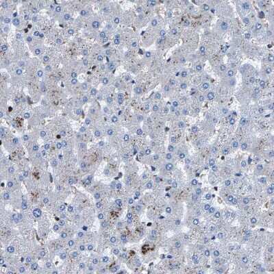 Immunohistochemistry-Paraffin: LPCAT1 Antibody [NBP1-88923] - Staining of human liver shows no positivity in hepatocytes as expected.